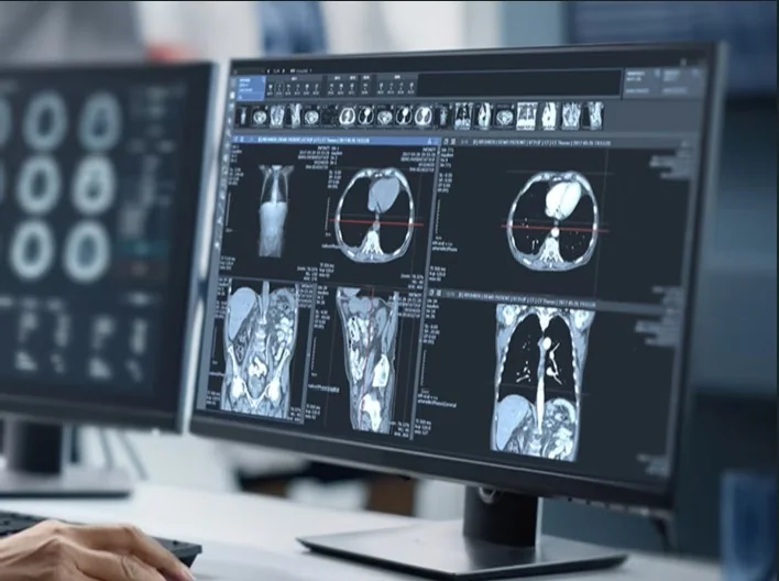 PACS 醫療影像資訊系統螢幕畫面，提供術前術後對照